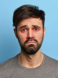 6 posibles razones que pueden causar ojos rojos
