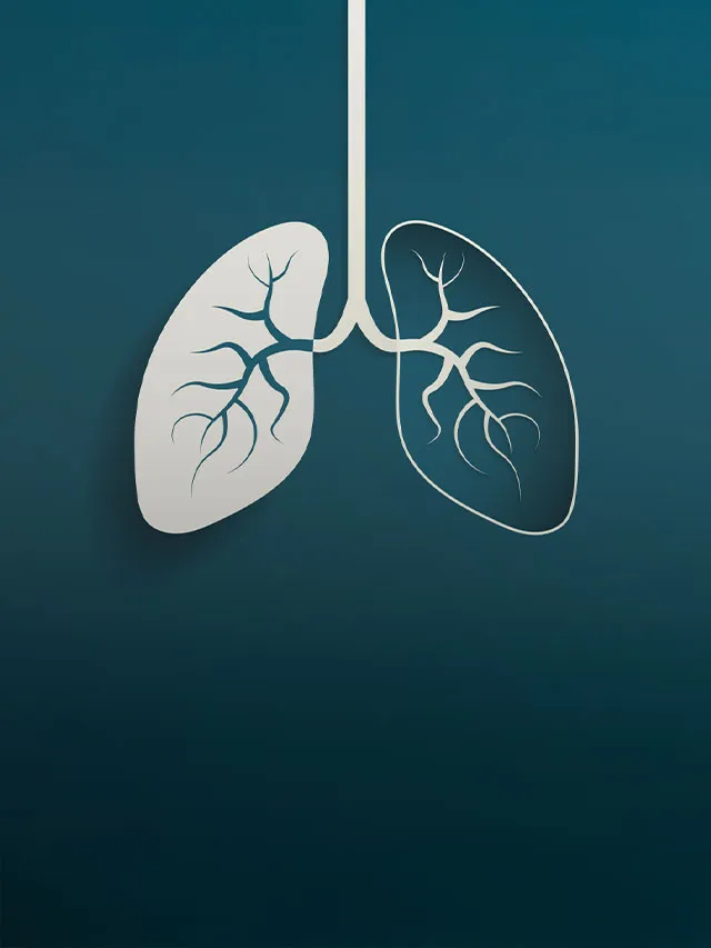 4 mitos del cáncer de pulmón
